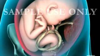 Breech Birth Position  3D Rotation [upl. by Nosemyaj]