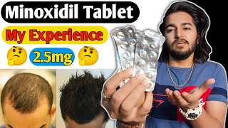 Minoxidil Tablet Experience  Lonitab 25mg Minoxidil Tablet [upl. by Nero]