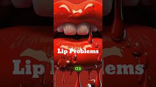 What Are the Most Common Lip Problems and How Can They Be Treated lips shorts fyp foryou [upl. by Latea23]