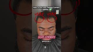 Fix Your Receding Hairline with These Quick Tips HairGrowth HairlineFix [upl. by Thad]