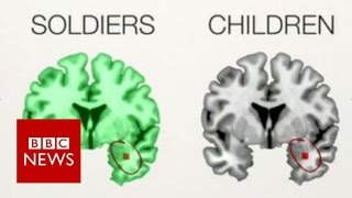 The PTSD brains of children amp soldiers  BBC News [upl. by Walter]