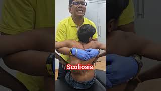 Scoliosis treatment [upl. by Perni]