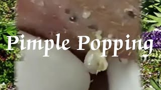 Pimple amp Blackheads Popping  24 [upl. by Nilrem771]