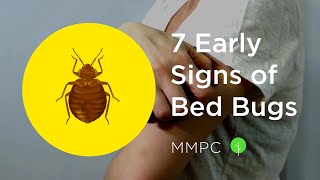 7 Early Signs of BED BUGS How to Know if You Have Bed Bugs [upl. by Jehiel25]