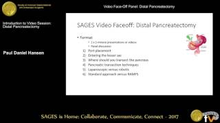 SAGES distal pancreatectomy video faceoff [upl. by Guinna]