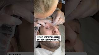 Milien entfernen☑️ hautpflege skincare gesichtsbehandlung kosmetiker ausreinigen [upl. by Allx359]