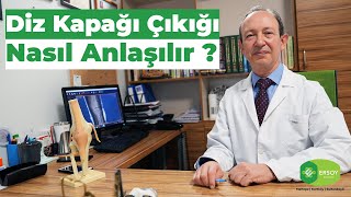 DİZ KAPAĞI ÇIKIĞI NASIL İYİLEŞR   PROFDRYAKUP YILDIRIM ANLATIYOR [upl. by Natsirc]