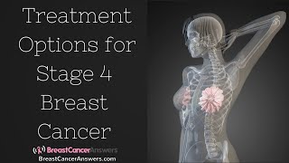 What Are the Treatment Options for Stage 4 Breast Cancer [upl. by Idram415]