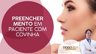 Preencher mento em paciente com covinha [upl. by Leanna]