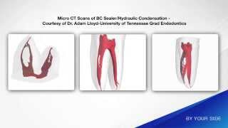 Bioceramic Bonding amp Research [upl. by Essilevi]