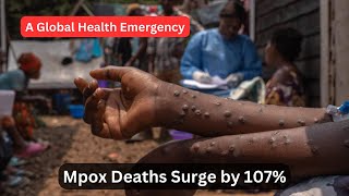 Rising Mpox Deaths A Global Health Crisis [upl. by Yobybab]