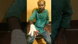 Little finger and ring finger fracture சுண்டுவிரல் மற்றும் மோதிரவிரல் எலும்புமுறிவு shorts [upl. by Enyale]