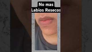 Mejor remedio para Labios Resecos  Elimina labios resecos en un dia [upl. by Quickel453]