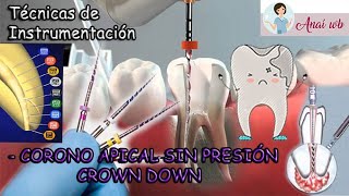 ENDODONCIA  Técnicas de Instrumentación Corono Apical o Crown Down  PARTE 2 [upl. by Liartnod899]