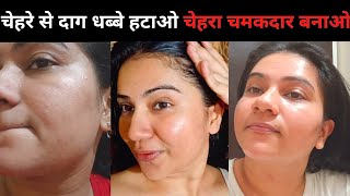 Tips To Get Rid Of Acne Scars  चेहरे से दाग धब्बे हटाओ चेहरा चमकदार बनाओ 😱 Khushbu Sharma [upl. by Kho581]