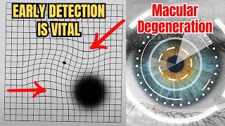 Detect Early Signs of Macular Degeneration with the Amsler Grid Test [upl. by Trebmer]