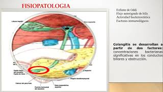 Colangitis aguda fisiopatologia [upl. by Case609]