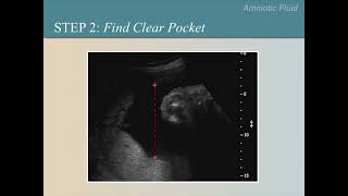 Ultrasound Training Course 10 part 1 [upl. by Avehsile]