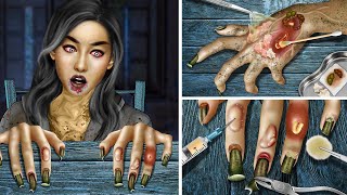 ASMR Zombie Treatment for deformed hands and ingrown nail [upl. by Dollar444]