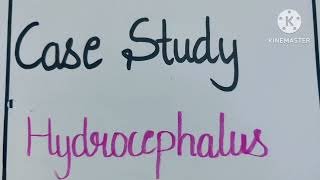 Case study on Hydrocephalus casestudy nursingcareplan pediatrics ncp [upl. by Ynottirb]