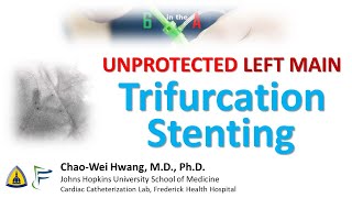 Left Main Trifurcation Stenting [upl. by Leeland]