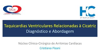 Taquicardias Ventriculares Relacionadas à Cicatriz Diagnóstico e Abordagem  Cristiano Pisani [upl. by Ahtaga51]