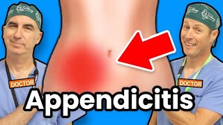 Appendicitis  How Do I Know If I Have Appendicitis [upl. by Darlene410]