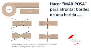 Hacer Mariposa con microporo Hacer vendoletes con microporo fácil [upl. by Nnaeiluj]