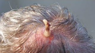 Removing A Massive Botfly Inside Cats Head Part 23 [upl. by Baillie486]