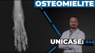 UNICASE 44  Osteomielite [upl. by Unam827]