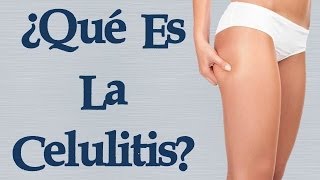 Que es la Celulitis  Descubre Todo sobre la Celulitis Que es Como se Forma y Como Eliminarla [upl. by Howund]