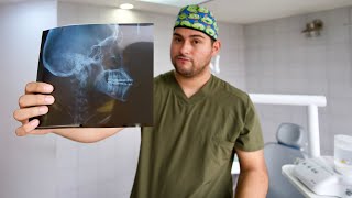 LA RADIOGRAFÍA MÁS IMPORTANTE DE TU TRATAMIENTO DE ORTODONCIA 🔥 ¿DIENTES VOLADOS CON BRACKETS [upl. by Nwahsek]