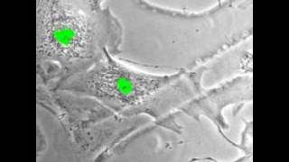 Regenerating heart cells [upl. by Rodmun]