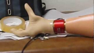 Emily Von Dollen  adapting her Myoelectric Prosthetic Hand Controller [upl. by Yanal592]