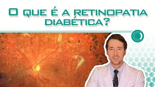 O que é a retinopatia diabética [upl. by Asirap345]