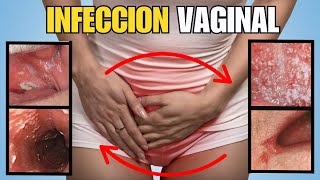 INFECCIONES Vaginales  Síntomas y Soluciones [upl. by Farly]