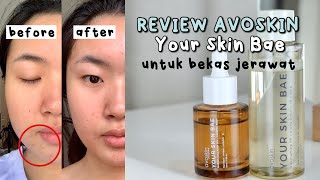 REVIEW AVOSKIN Your Skin Bae ampuh BANGET untuk bekas jerawat Indonesia [upl. by Angele]