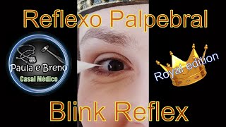 Reflexo córneopalpebral  Corneal reflex Royal edition [upl. by Hsital]