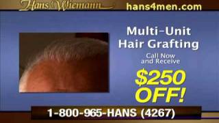 MultiUnit Hair Grafting at Hans Wiemann in St Louis [upl. by Oloapnaig632]