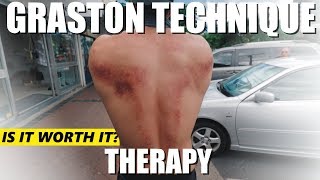 Graston Technique Muscle Scraping  MY EXPERIENCE [upl. by Gerita]