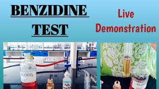 Benzidine test  Blood in urine  Hematuria  Biochemistry [upl. by Relyhcs]