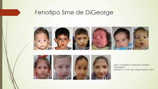 DIAGNÓSTICO PRENATAL Y SEGUIMIENTO DE LOS SÍNDROMES GENÉTICOS Dra M Fernanda Madeira [upl. by Tnafni580]