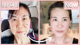 Japanese secret to look 10 years younger than your age antiaging wrinkle treatment [upl. by Olva483]