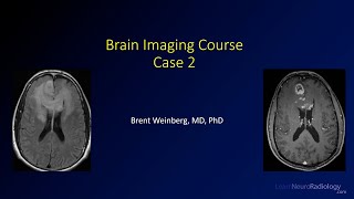 Brain imaging course – Unknown case 2 [upl. by Loralie]