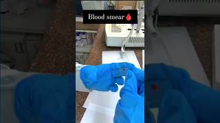 Blood Smear Under microscope 🔬 microscope wbc microbiology ytshorts labtechnician yt biology [upl. by Aniteb]