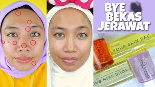 SKINCARE UNTUK BEKAS JERAWAT Avoskin Your Skin Bae  Aro Kopa [upl. by Anahsak]