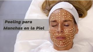 Peeling para Manchas en la Piel [upl. by Aneala942]