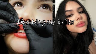 Getting my lip filler dissolved  raw footage [upl. by Enitsenre]