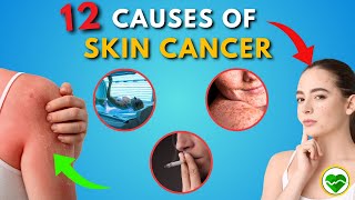 Top 12 Causes of SKIN CANCER You Should Know  Melanoma [upl. by Asilegna343]