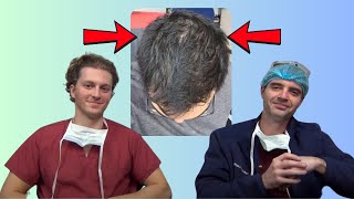 Can Diffuse Thinners Get a Hair Transplant [upl. by Ailehc]